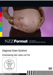 Diagnose Down Syndrom