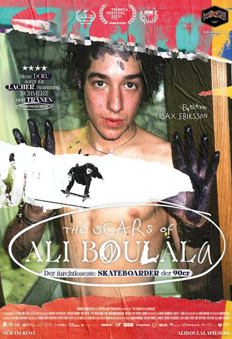 The Scars of Ali Boulala